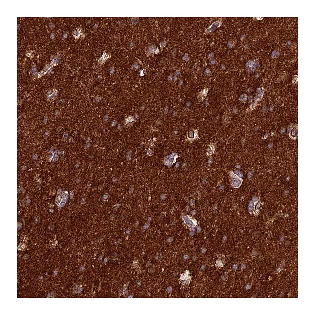 Atlas Antibodies Anti-ST8SIA5 Antibody
