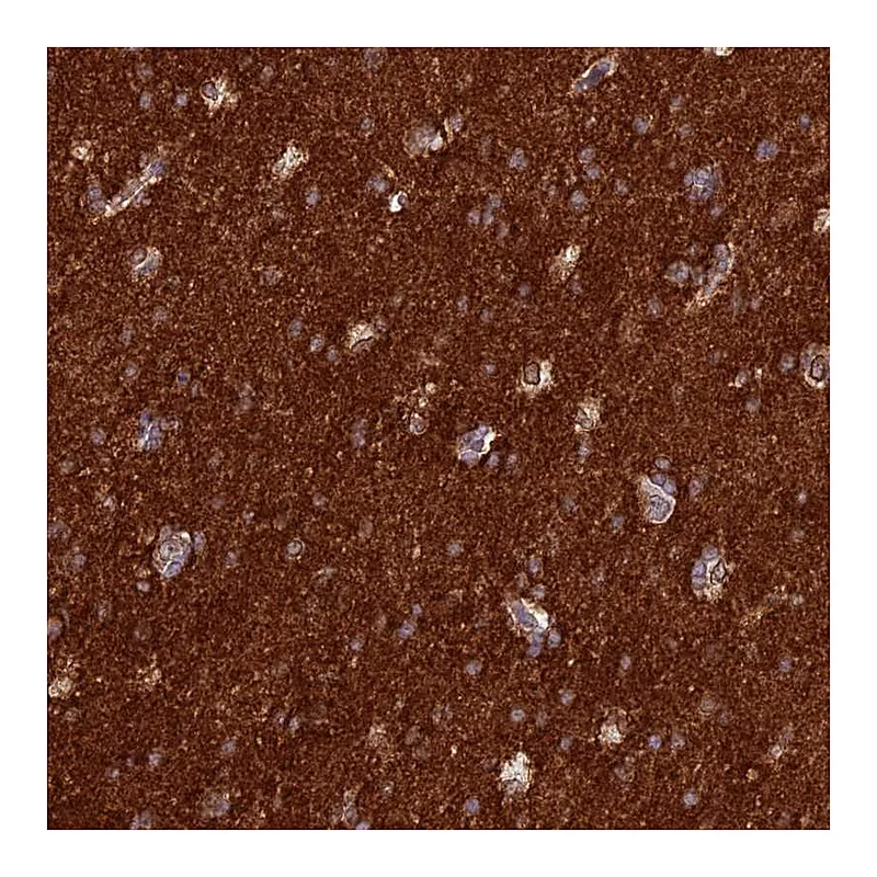 Atlas Antibodies Anti-ST8SIA5 Antibody
