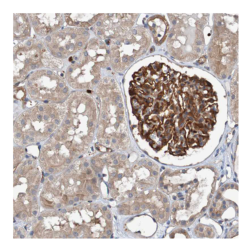 Atlas Antibodies Anti-ST8SIA6 Antibody