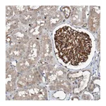 Atlas Antibodies Anti-ST8SIA6 Antibody