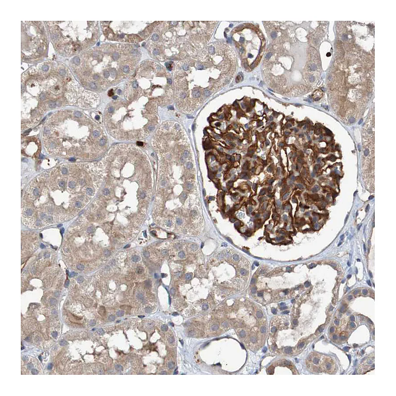 Atlas Antibodies Anti-ST8SIA6 Antibody