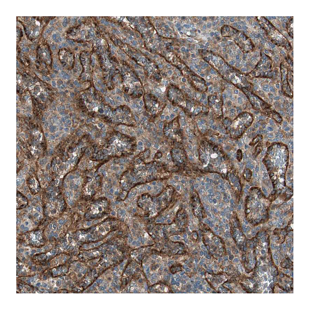 Atlas Antibodies Anti-STAB1 Antibody