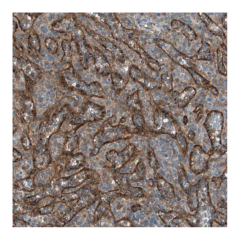 Atlas Antibodies Anti-STAB1 Antibody
