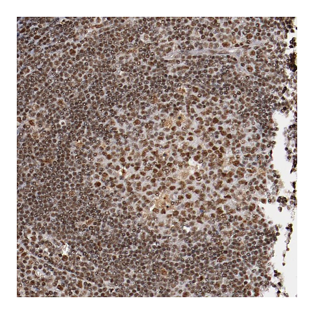 Atlas Antibodies Anti-STAG2 Antibody