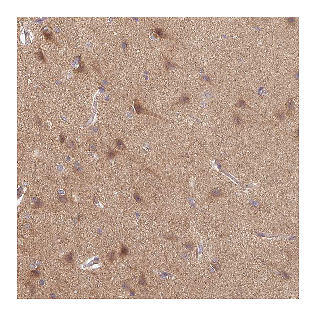 Atlas Antibodies Anti-STAM Antibody