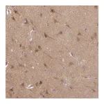 Atlas Antibodies Anti-STAM Antibody