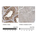 Atlas Antibodies Anti-STAM2 Antibody
