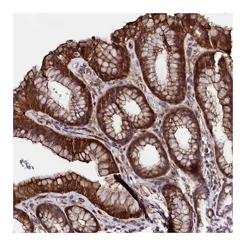 Atlas Antibodies Anti-STAMBPL1 Antibody