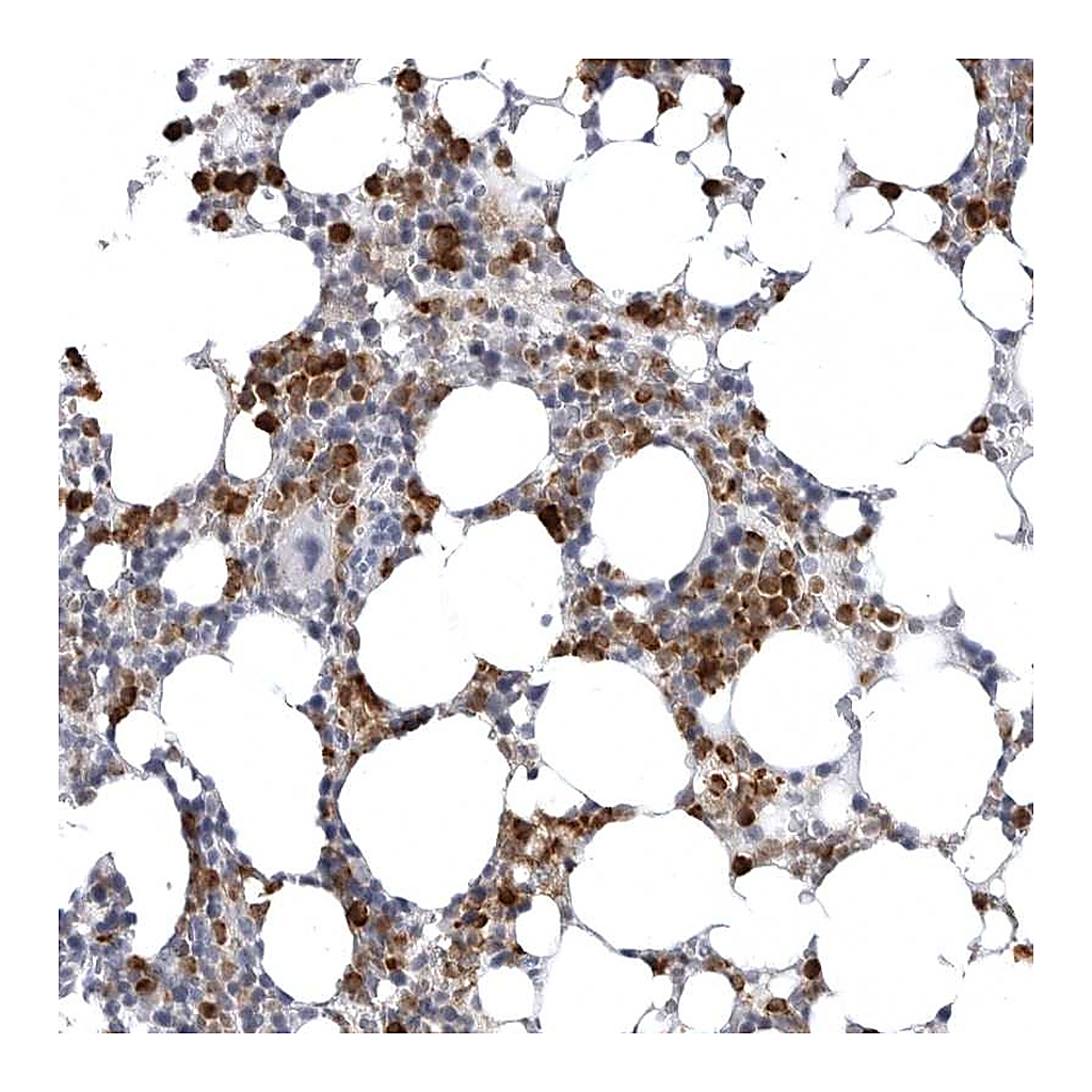 Atlas Antibodies Anti-STAP2 Antibody