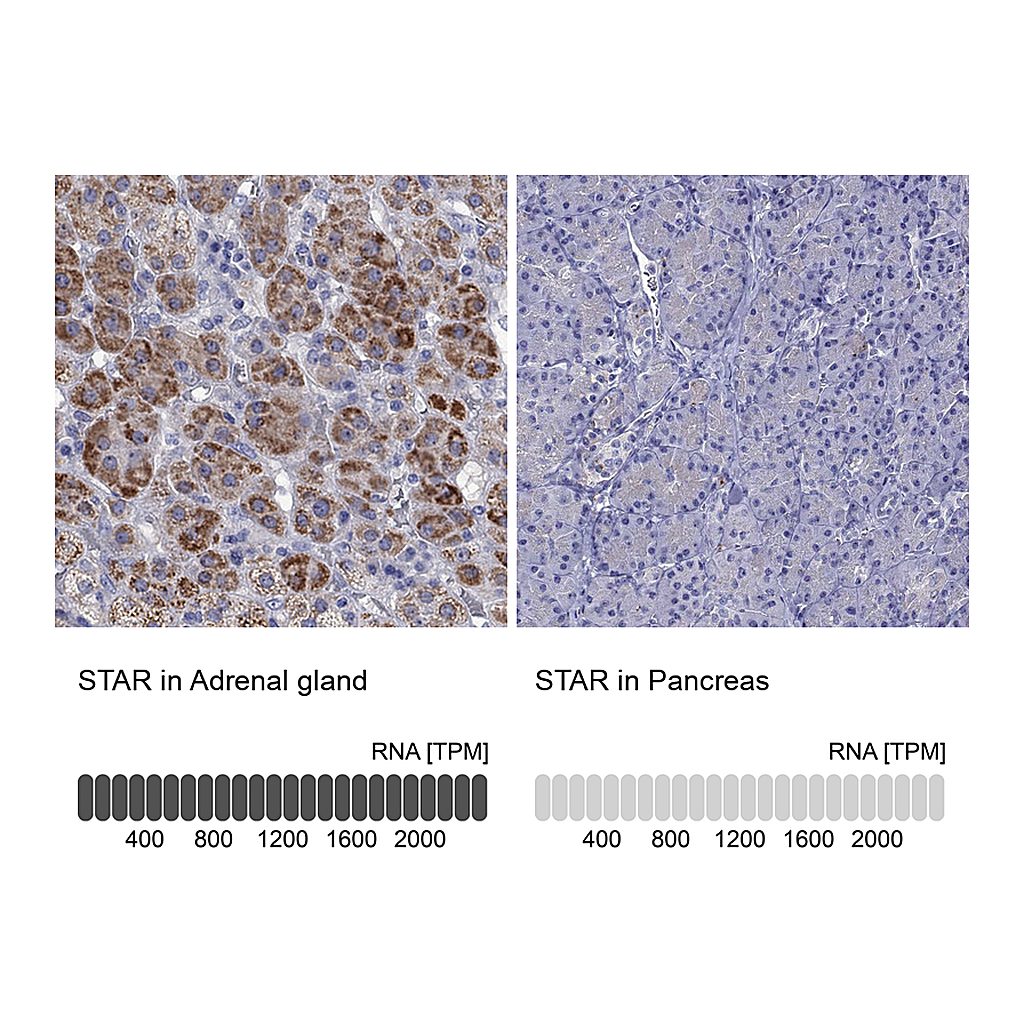 Atlas Antibodies Anti-STAR Antibody