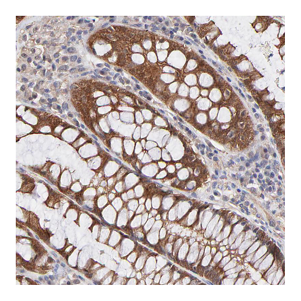 Atlas Antibodies Anti-STAP2 Antibody