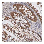 Atlas Antibodies Anti-STAP2 Antibody
