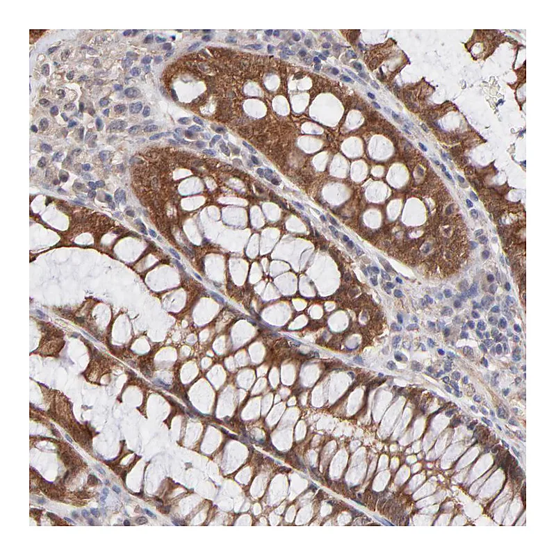 Atlas Antibodies Anti-STAP2 Antibody