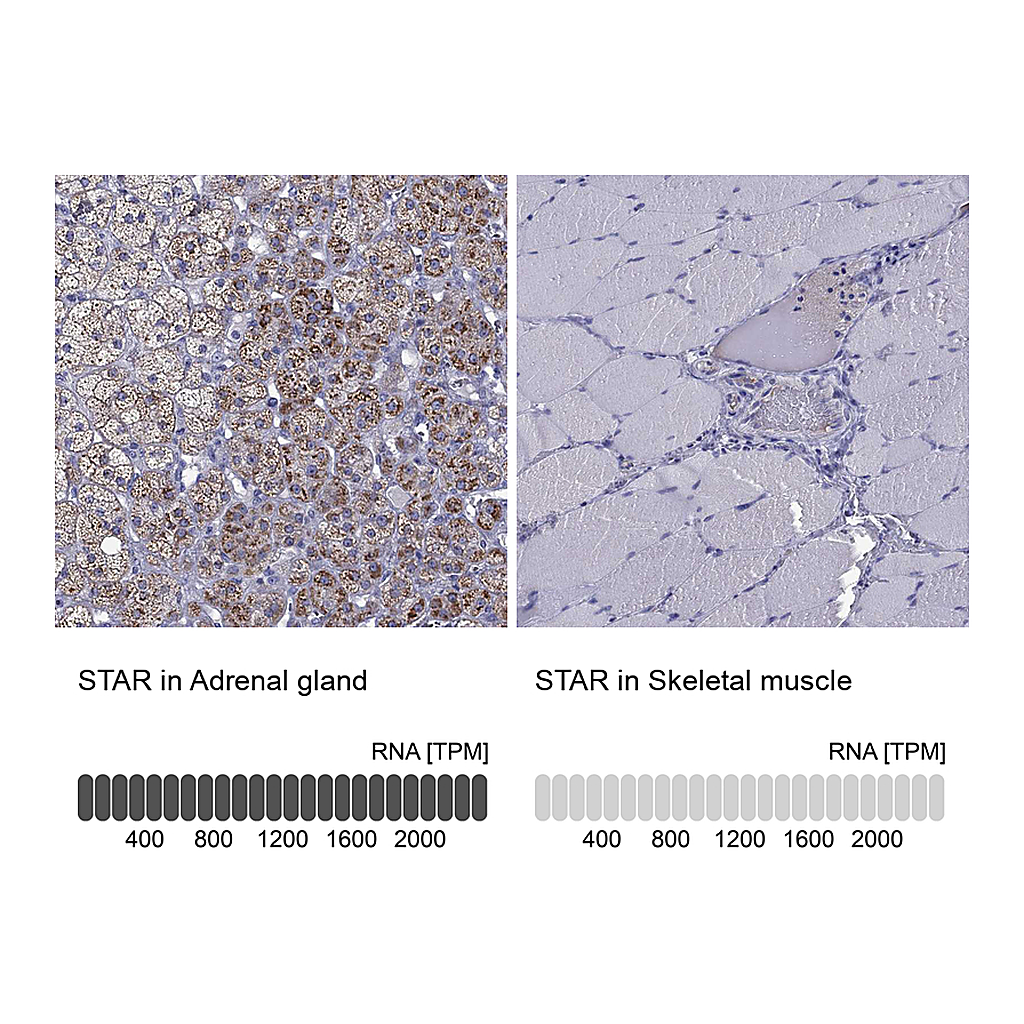 Atlas Antibodies Anti-STAR Antibody
