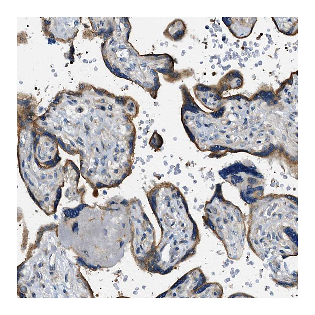Atlas Antibodies Anti-STARD13 Antibody
