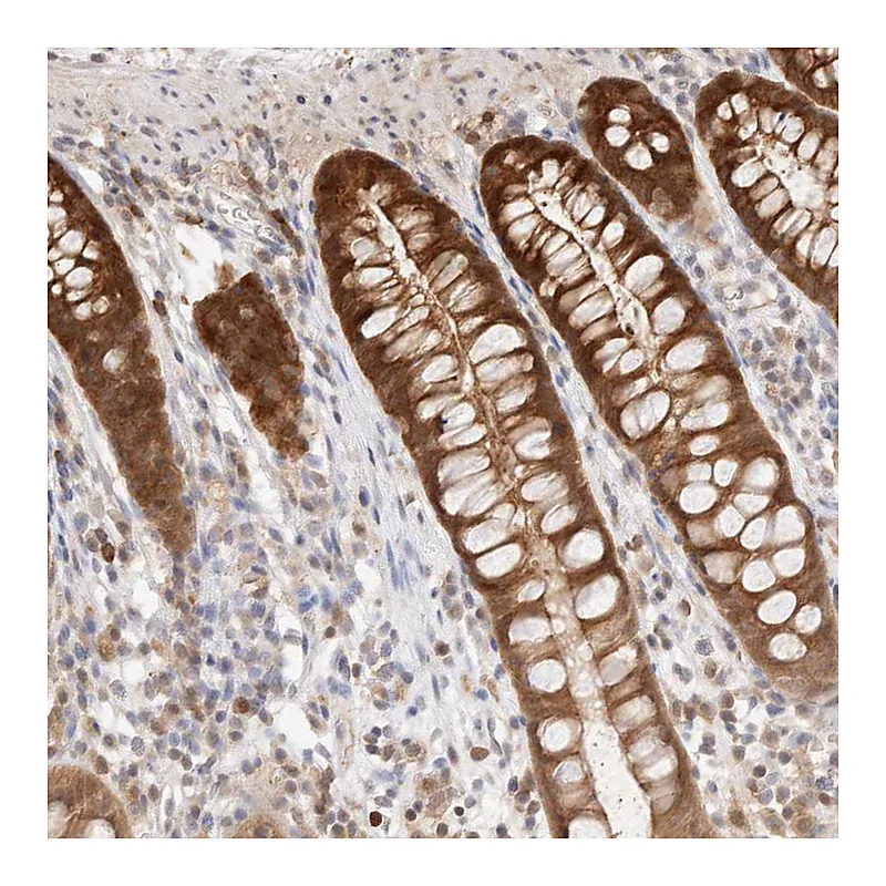 Atlas Antibodies Anti-STARD10 Antibody