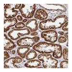 Atlas Antibodies Anti-STARD8 Antibody