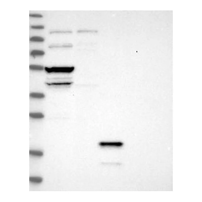 Atlas Antibodies Anti-STARD3 Antibody