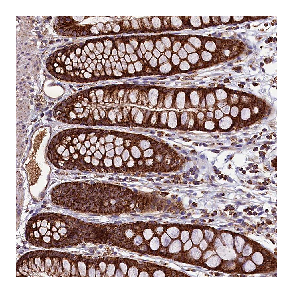 Atlas Antibodies Anti-STARD5 Antibody