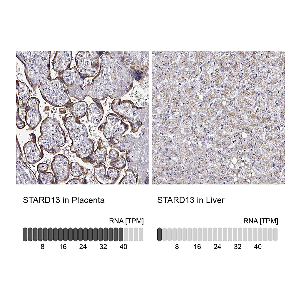 Atlas Antibodies Anti-STARD13 Antibody