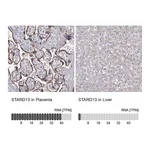 Atlas Antibodies Anti-STARD13 Antibody