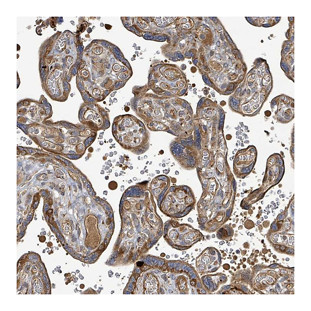 Atlas Antibodies Anti-STARD4 Antibody