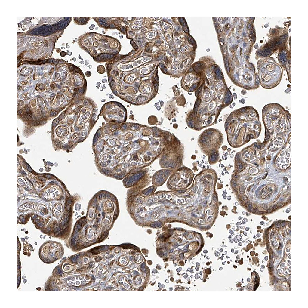 Atlas Antibodies Anti-STARD4 Antibody