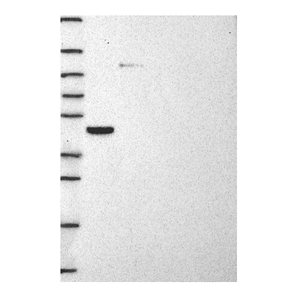 Atlas Antibodies Anti-STARD3 Antibody
