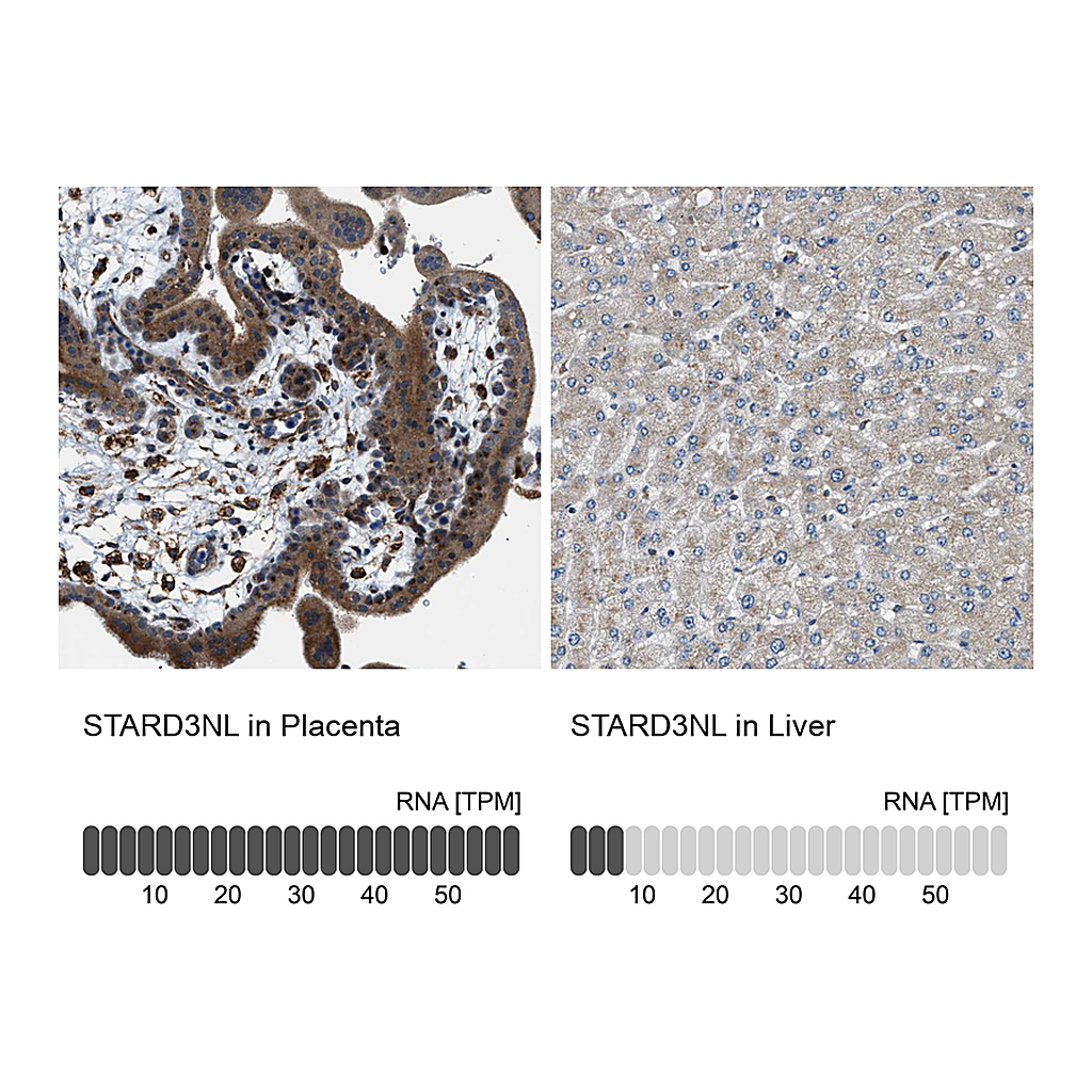 Atlas Antibodies Anti-STARD3NL Antibody
