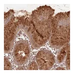 Atlas Antibodies Anti-STARD7 Antibody