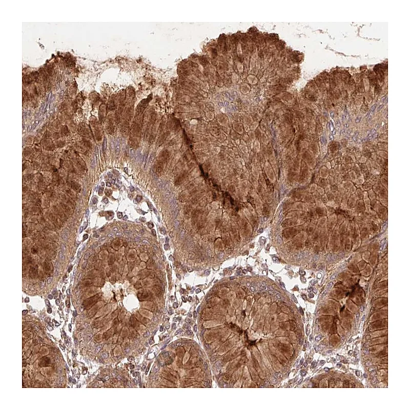 Atlas Antibodies Anti-STARD7 Antibody