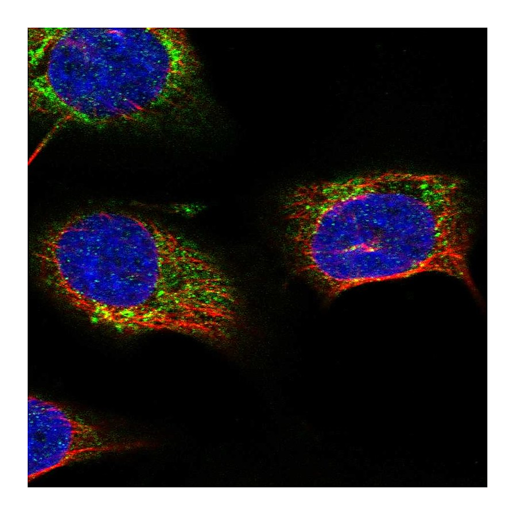 Atlas Antibodies Anti-STARD7 Antibody