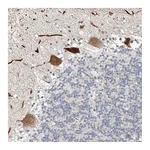 Atlas Antibodies Anti-STARD9 Antibody