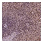 Atlas Antibodies Anti-STAT3 Antibody