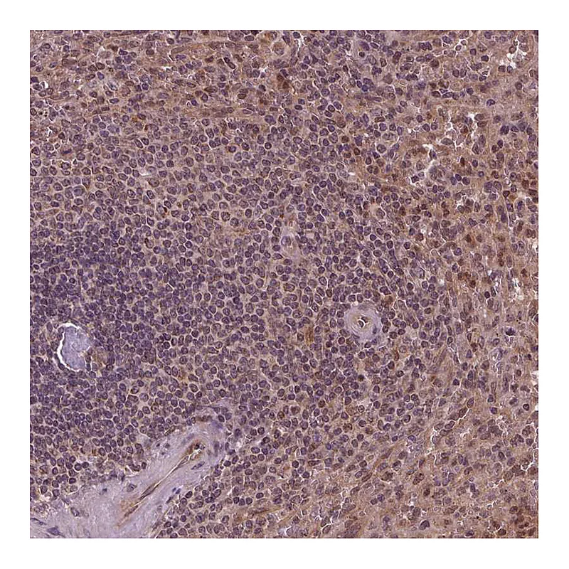 Atlas Antibodies Anti-STAT3 Antibody