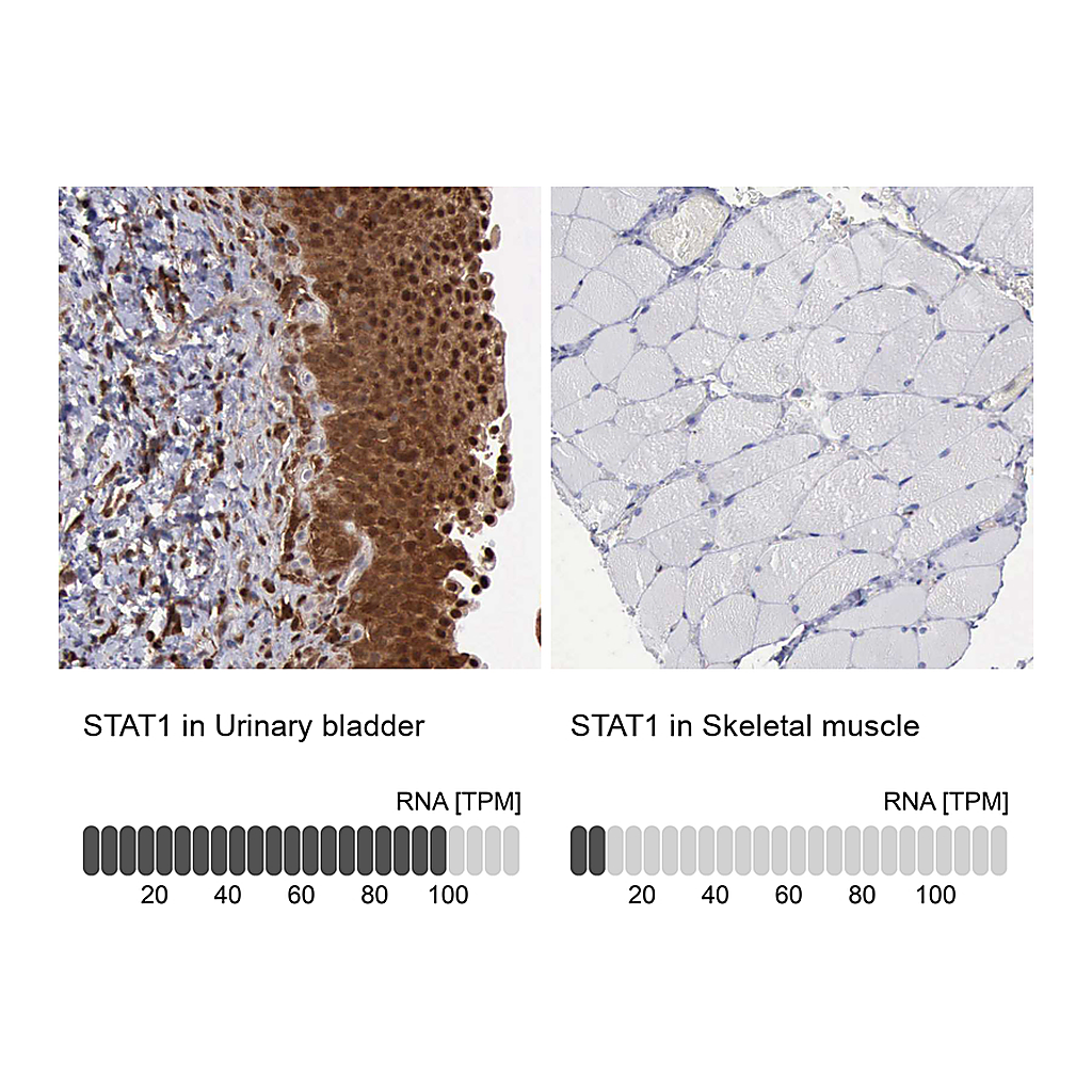 Atlas Antibodies Anti-STAT1 Antibody