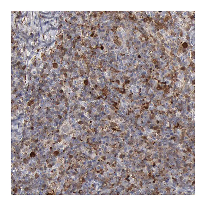 Atlas Antibodies Anti-STAT1 Antibody