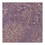 Atlas Antibodies Anti-STAT5A Antibody