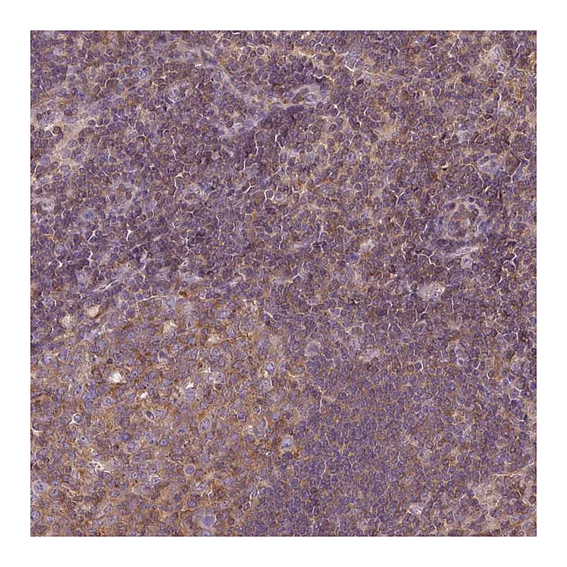 Atlas Antibodies Anti-STAT5A Antibody
