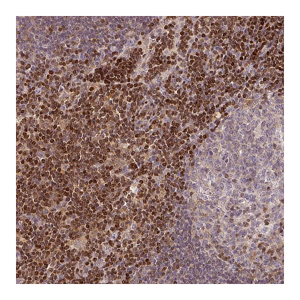 Atlas Antibodies Anti-STAT5A Antibody