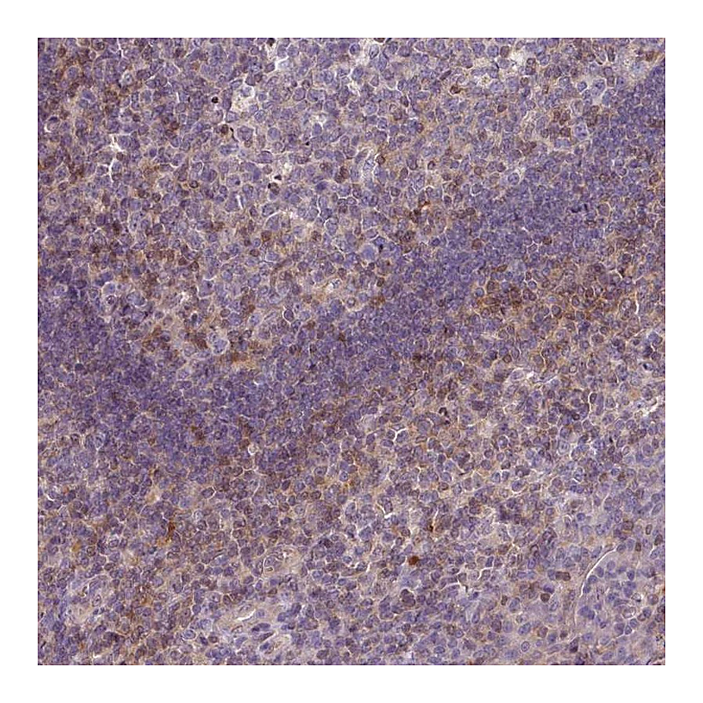 Atlas Antibodies Anti-STAT5A Antibody