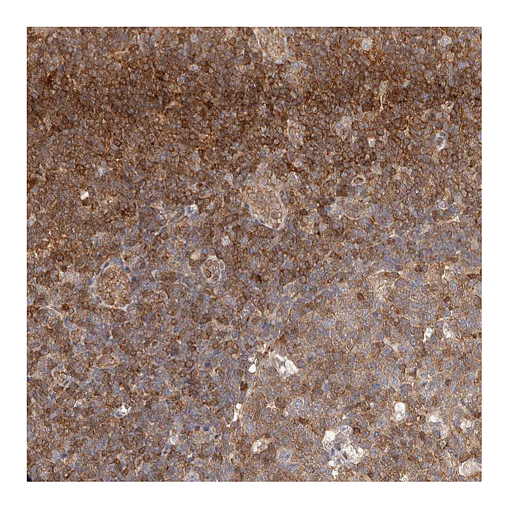Atlas Antibodies Anti-STAT5A Antibody
