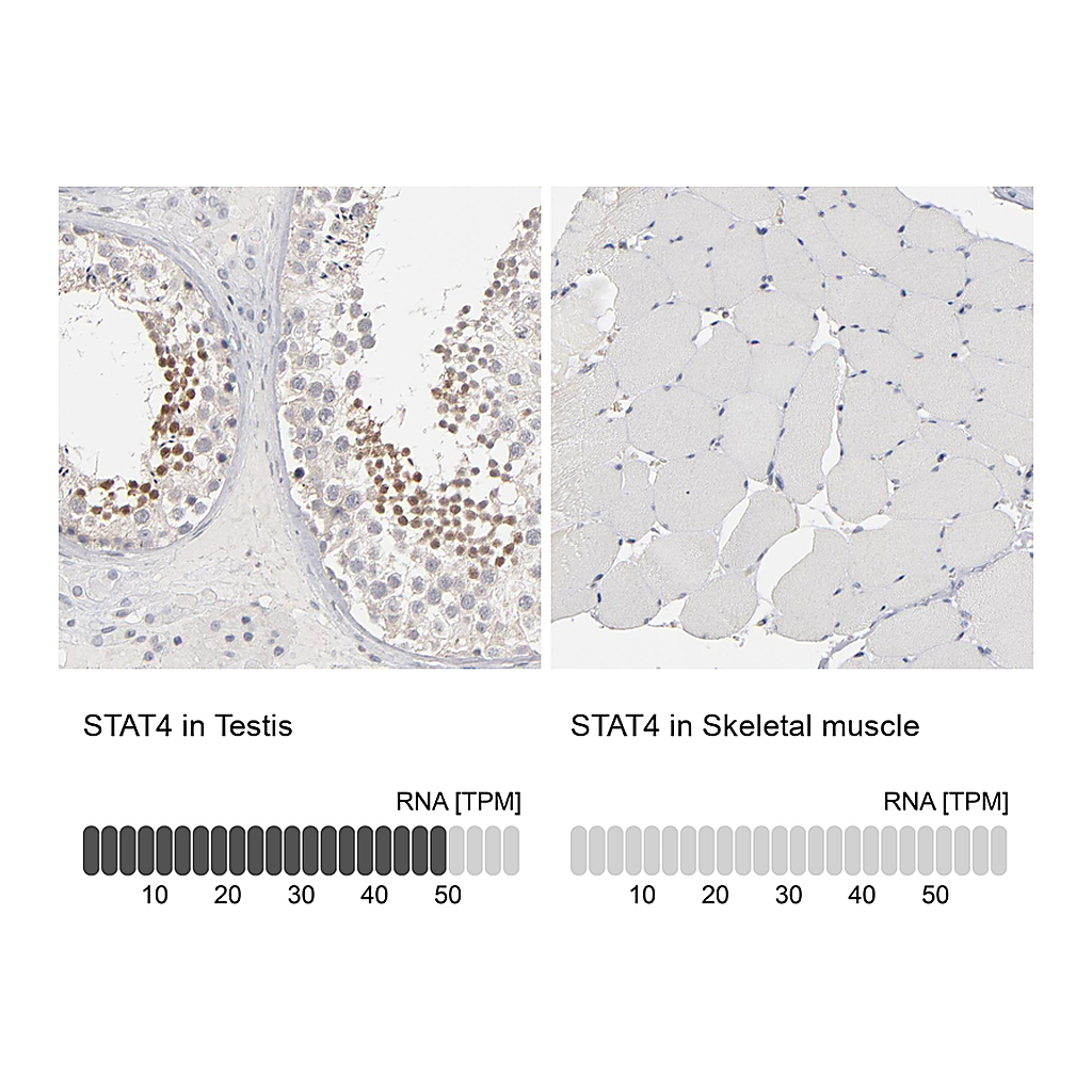 Atlas Antibodies Anti-STAT4 Antibody