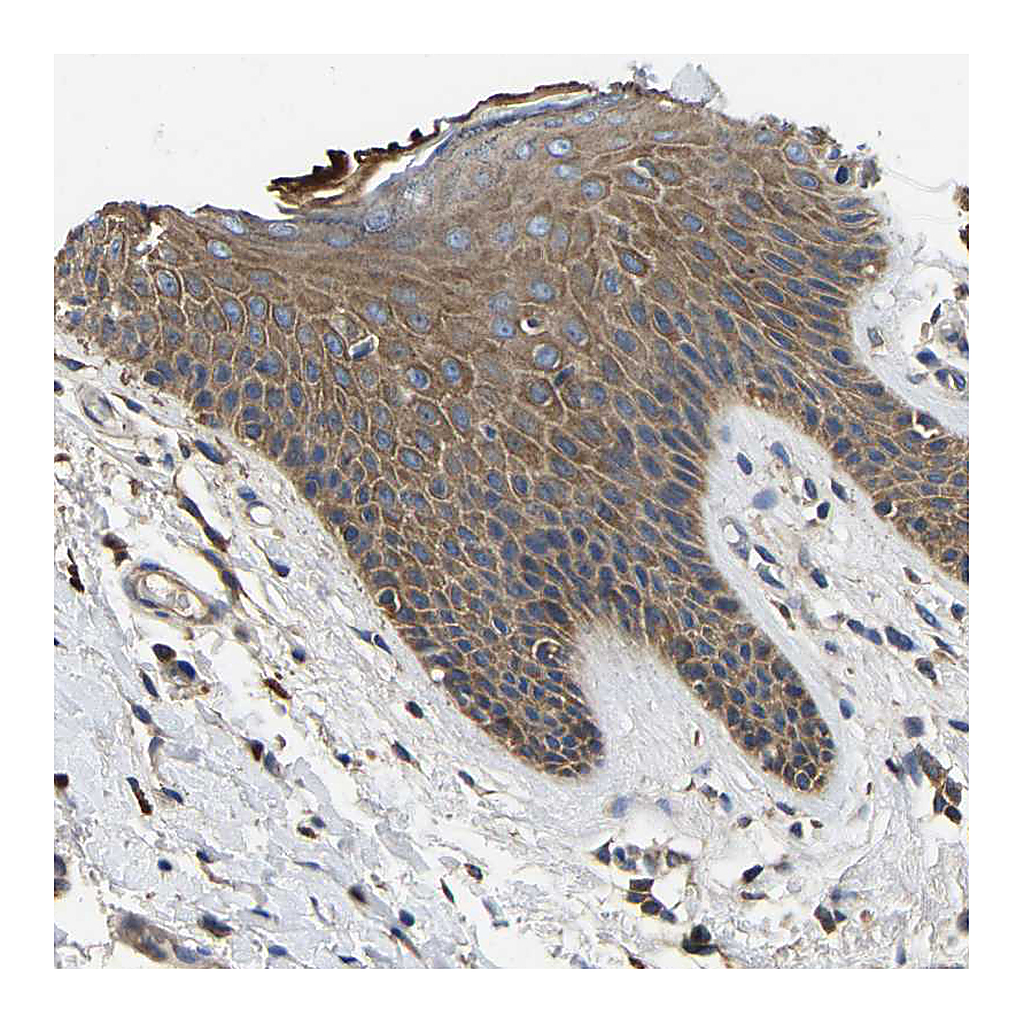 Atlas Antibodies Anti-STAT2 Antibody