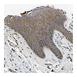 Atlas Antibodies Anti-STAT2 Antibody