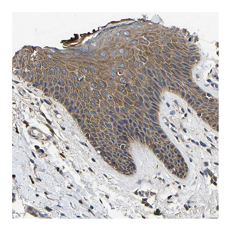 Atlas Antibodies Anti-STAT2 Antibody