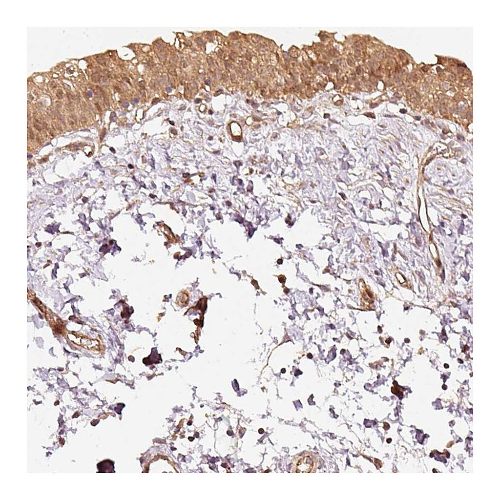 Atlas Antibodies Anti-STAU1 Antibody