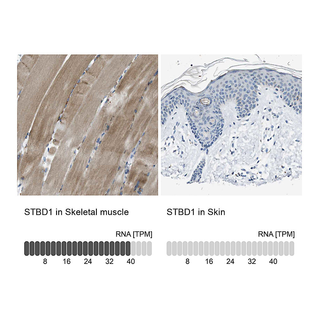 Atlas Antibodies Anti-STBD1 Antibody