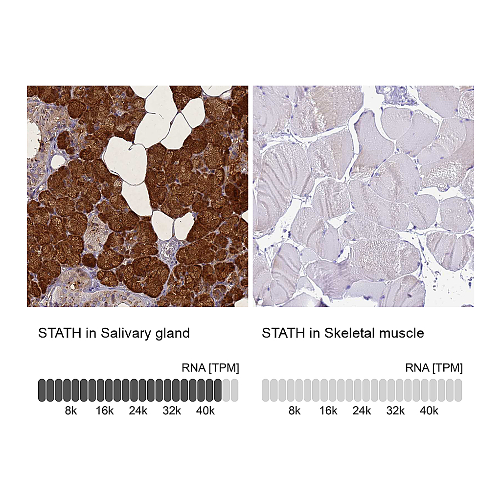 Atlas Antibodies Anti-STATH Antibody