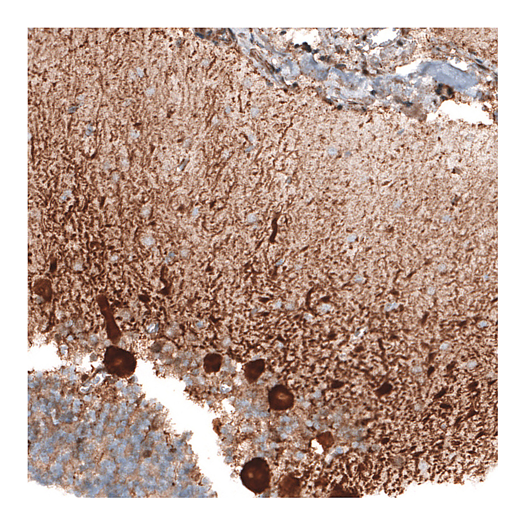 Atlas Antibodies Anti-STAU2 Antibody
